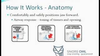 How It Works.f4v