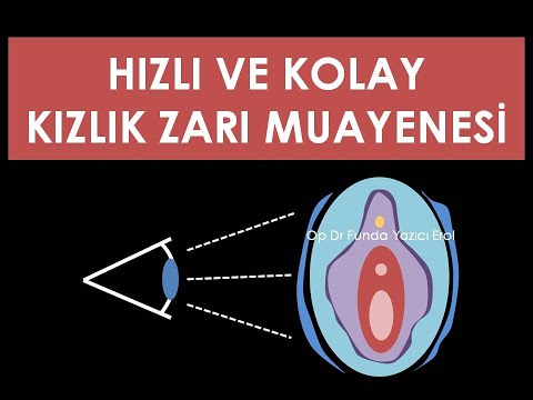 Kolay ve Hızlı Kızlık Zarı Muayenesi Antalya - Op. Dr. Funda Yazıcı Erol