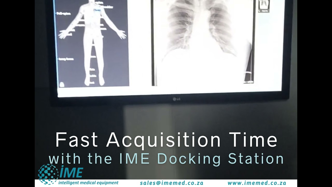 Mobile Xray Trailer YouTube