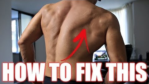 3 Exercises to Fix Scapular Winging (Fix a Winged Scapula)