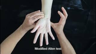 Allen Test, Modified Allen Test and Digital Allen Test - Supplementary Video 1