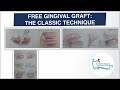 FREE GINGIVAL GRAFT: THE CLASSIC TECHNIQUE|PERIODONTAL PLASTIC AND ESTHETIC SURGERY|DR. ANKITA