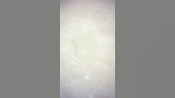 egg shell microscope #microscope #microscopic