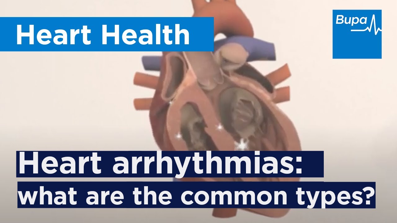 Heart arrhythmias: what are the common types? | Bupa Health