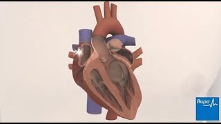 Common types of heart arrhythmias