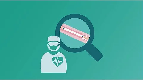 See clearly, stent confidently with StentBoost Live
