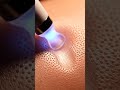 What Happens When This Touches Skin