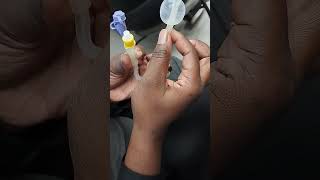 Gastrostomy Tube gtt