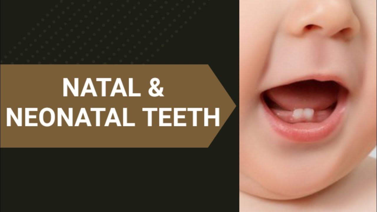 NATAL & NEONATAL TEETH YouTube
