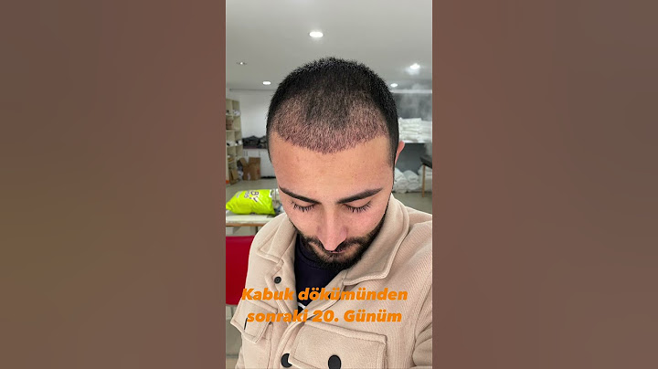 𝐀𝐑𝐊𝐀𝐃𝐀𝐒̧𝐋𝐀𝐑 𝟓𝟎.𝐆𝐔̈𝐍 𝐒𝐔̈𝐑𝐄𝐂𝐈̇𝐌𝐈̇ 𝐒𝐈̇𝐙𝐈̇𝐍 𝐈̇𝐋𝐄 𝐏𝐀𝐘𝐋𝐀𝐒̧𝐓𝐈𝐌🤩