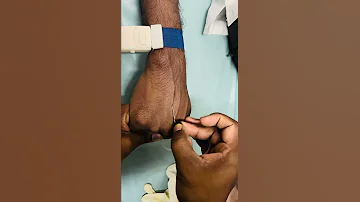 Scalp Vein Set Insertion Technique S V Set Insertion I V Injection Injection Reels Iv Shorts 