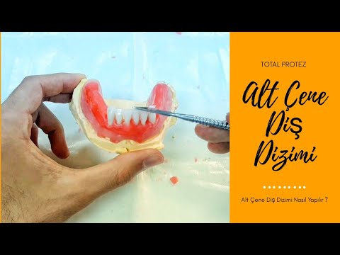 Hareketli Protezler Denture Dt Aysegul Ozturk Dis Klinigi