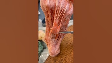 Real Human Foot Muscles!