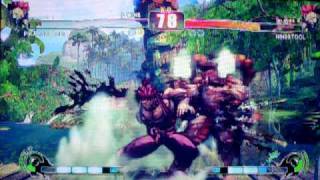 Street Fighter 4 Xbox 360 Online Matches Jr Rodriguez Vs Nin99Tool On Xbox Live On 10 26 09