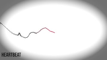 "Heartbeat"-AfterEffect & Trapcode Particular with Audio React.