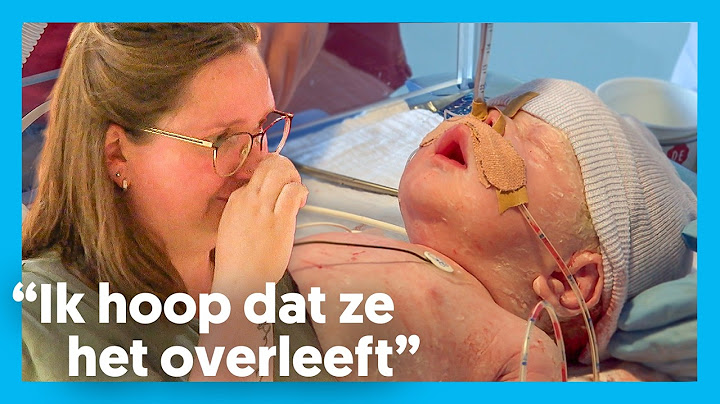 BABY wordt GEBOREN met GAT IN MIDDENRIF | Handen aan de couveuse | EO