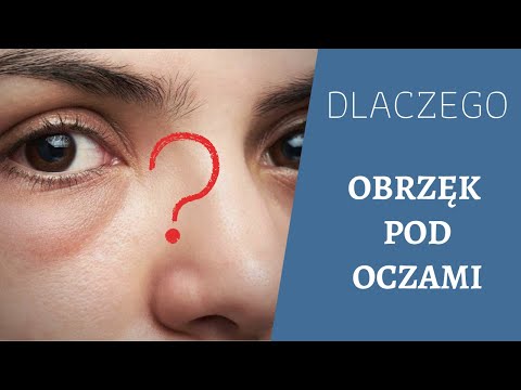 OBRZĘK pod OCZAMI, dlaczego się tworzy?