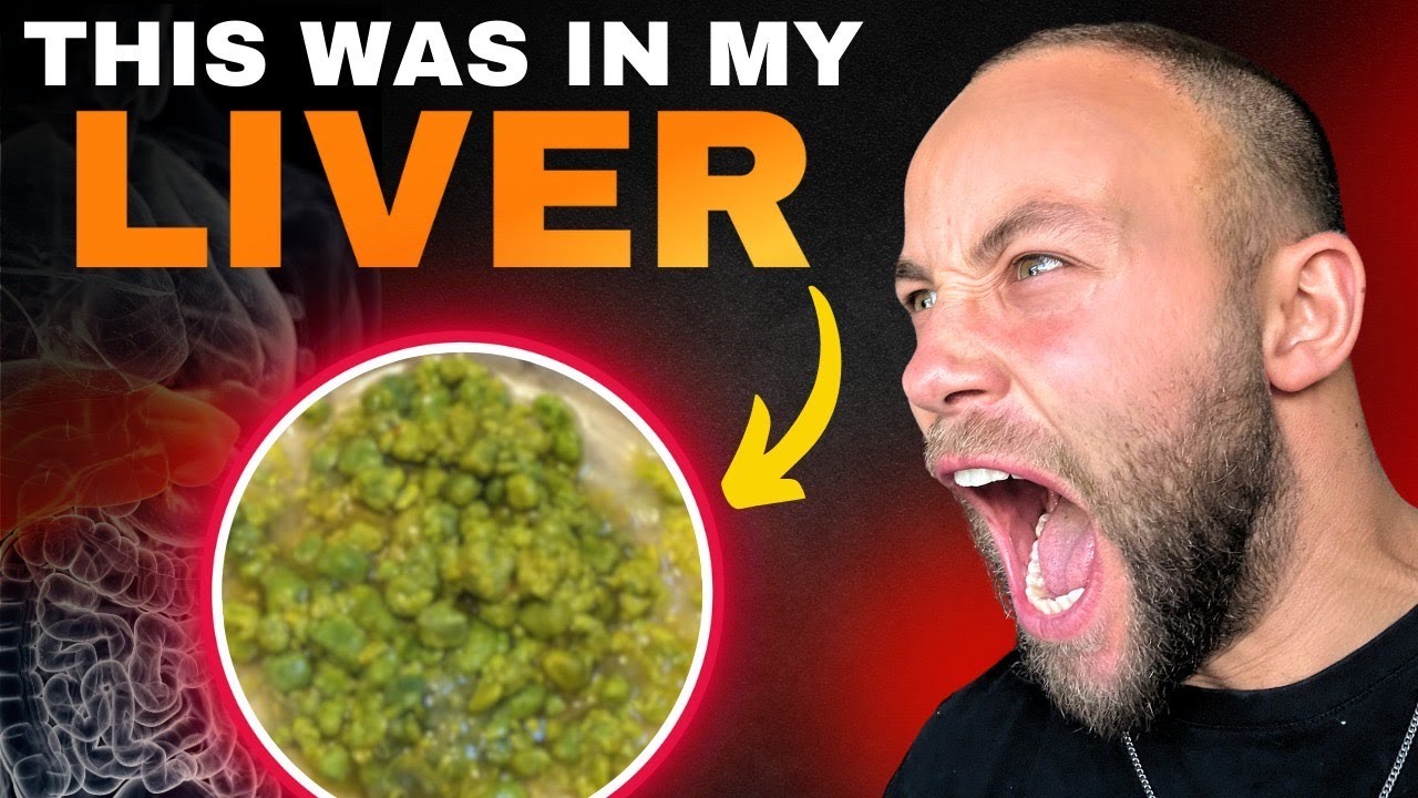 Want To Detox Parasites? Start With The Liver.