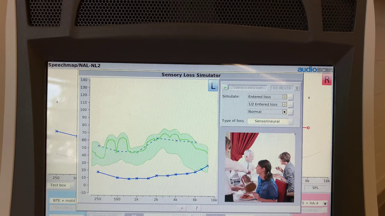 Simulation of hearing loss - YouTube