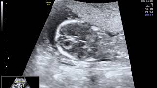 IMG 20171107 3
