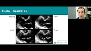 ASE 2021 Stress Echocardiography