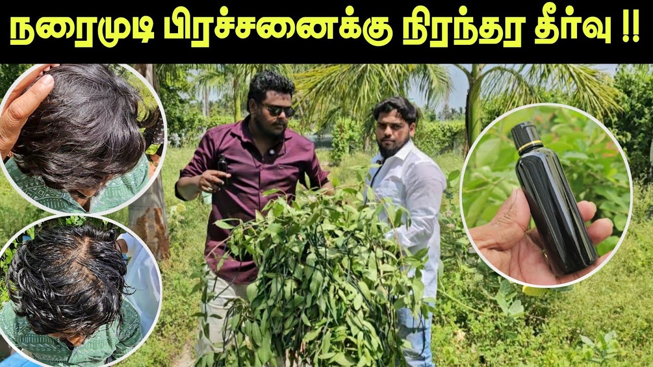 நரை முடி பிரச்சனைக்கு நிரந்தர தீர்வு 🔥