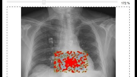 Hot Spot Questions in eSystem exam software