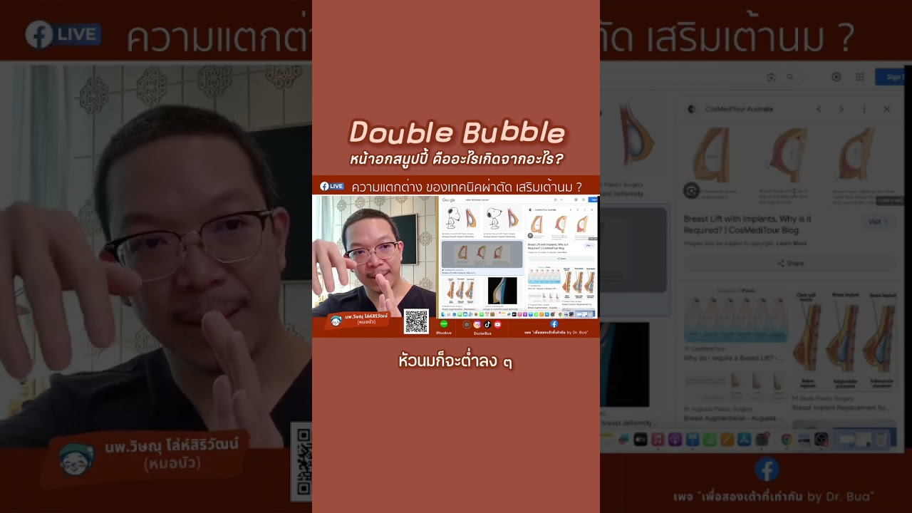 Double Bubble หน้าอกสนูปปี้คืออะไร เกิดจากอะไร?‼️ 