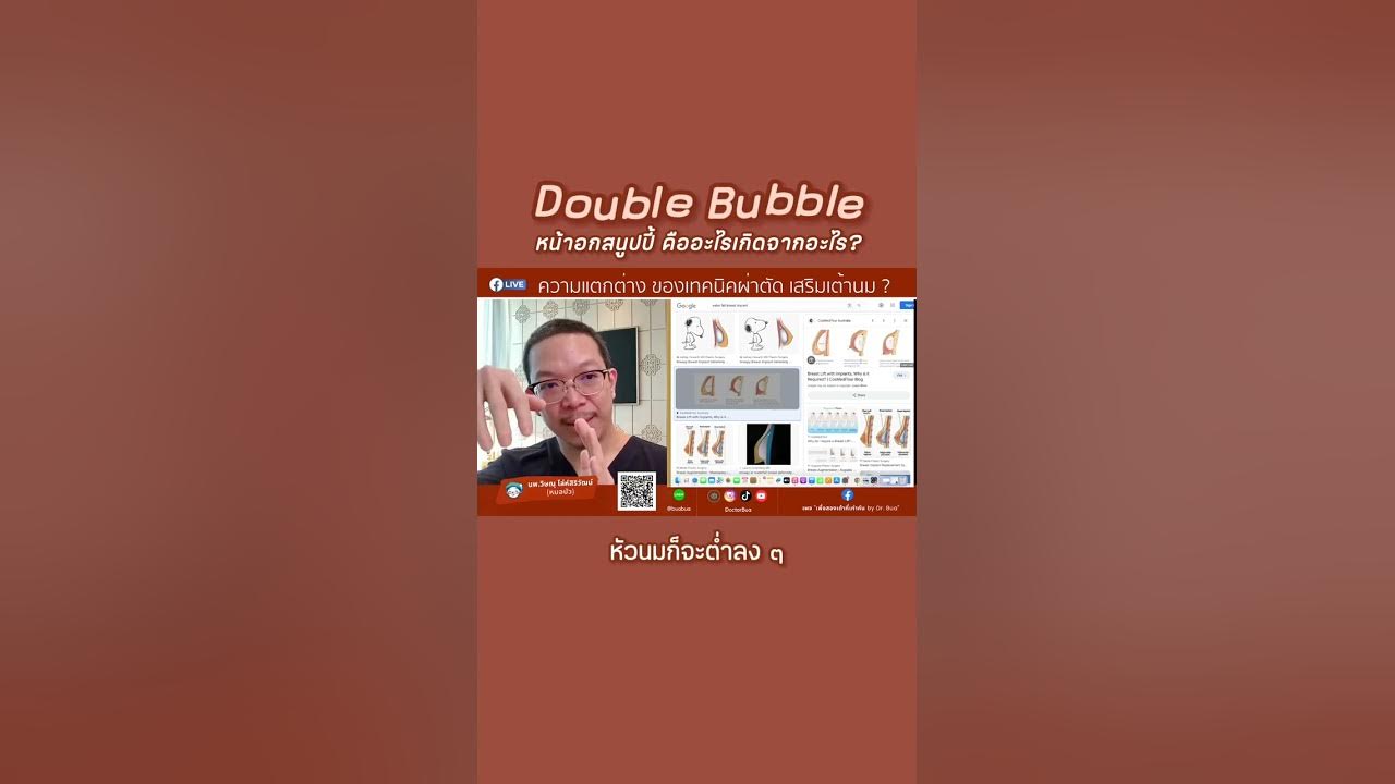 Double Bubble หน้าอกสนูปปี้คืออะไร เกิดจากอะไร?‼️ 