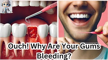 Bleeding Gums: Why Do Your Gums Bleed While Flossing? Here’s What You Need to Know!