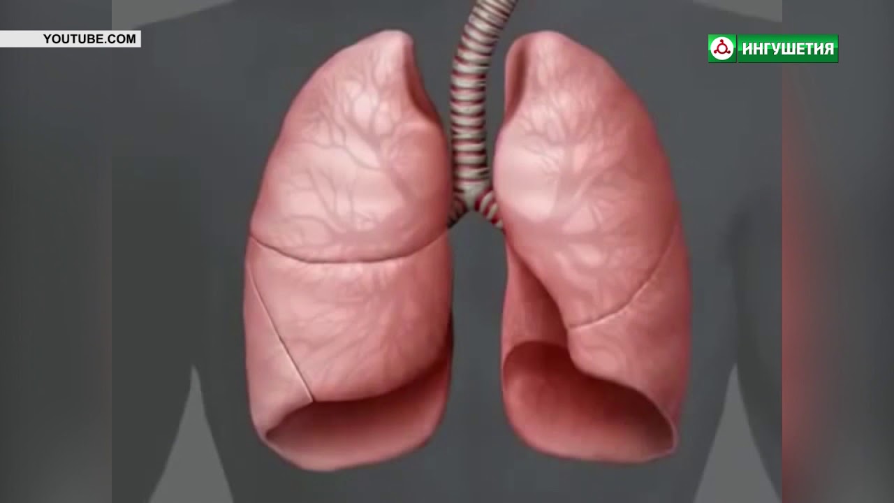 06072018 ЗДОРОВЬЕ ОТКРЫТАЯ ФОРМА ТУБЕРКУЛЕЗА