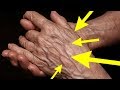 手の血管が浮き出る原因と自分でできる改善法