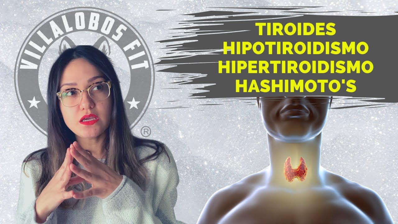 Hipotiroidismo de hashimoto y dieta keto