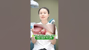 Mất răng sữa sớm - Ảnh hưởng lớn đến trẻ #nhakhoagreenlife #saurang #rangsua