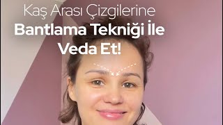 Kaş Arası Çizgi. Bantlama. Dogalgençleşme.