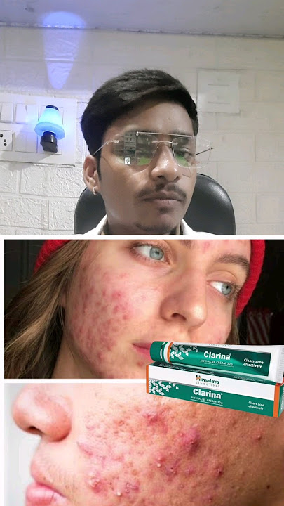 Clarina Cream कैसे करे? और क्या क्या फायदे है !!