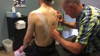REP Lab with Jay Dicharry - Shoulder Taping by Nathan Huff 107 views 1 month ago 3 minutes, 4 seconds