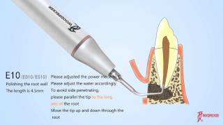 WOODPECKER TIP-E10/E10D