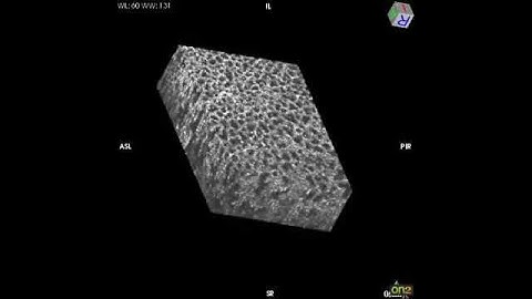 3D mouse lung with Light-CT