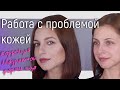 РАБОТА С ПРОБЛЕМНОЙ КОЖЕЙ. ПРЫЩИ. КОРРЕКЦИЯ ЛИЦА ДЛЯ КВАДРАТНОЙ ФОРМЫ