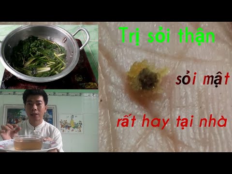 Sau 1 tuần, sỏi thận , sỏi mật khỏi ngay tại nhà chỉ bằng 1 nắm rau mùi tàu @vinh vlog nam dược