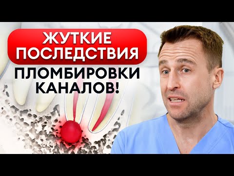 Главный признак плохой пломбы / Как проверить своего стоматолога?