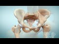Pediatric Hip Arthroscopy at Children’s Healthcare of Atlanta