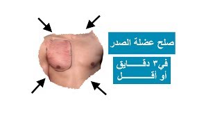 عالج شد و ألم عضلة الصدر في أقل من 3 دقائق!!!!