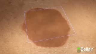 sun spot removal