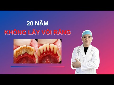 Video: Phỏng vấn Bezler