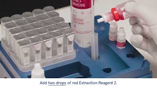 EN – QuikRead go Strep A – Test procedure using QuikRead go Plus Instrument