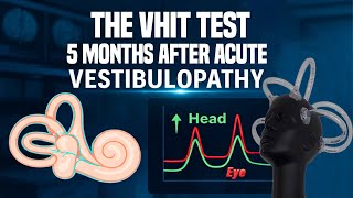 The VHIT test 5 months after acute vestibulopathy