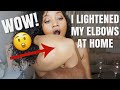 OMG this worked! I Lightened My Dark Elbows At Home *works for dark knees too* | Victoria Victoria