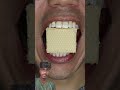 #food #mukbang #chocolate #duet #candy